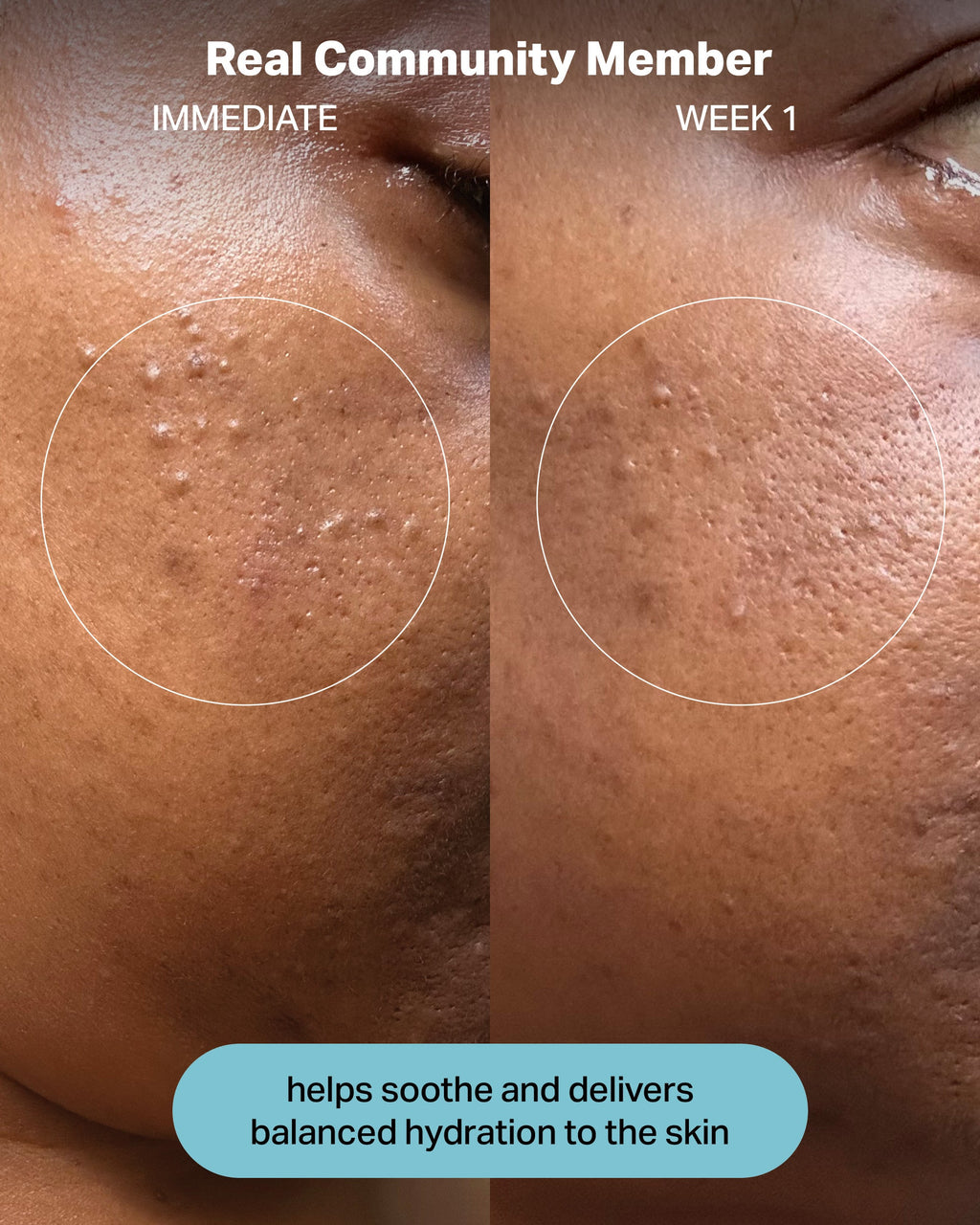 Hydrating Electrolyte Rescue Serum product image 8